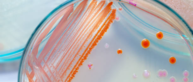 Microbiology Solutions